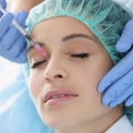 The Subtle Boost: How Closed Rhinoplasty In Chicago Elevates Your Beauty Salon Visits
