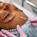 Choosing Quality Over Convenience: Why Medical Spas Trump Beauty Salons For Botox In Nashville
